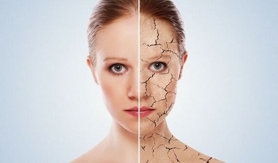sebelum dan selepas peremajaan kulit