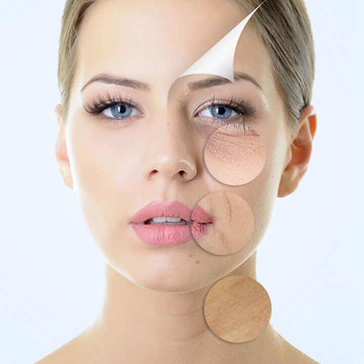 Ketidaksempurnaan kulit muka - petunjuk untuk prosedur anti-penuaan