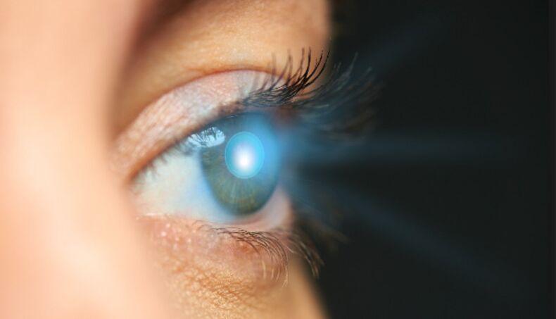 peremajaan kulit di sekitar mata dengan laser